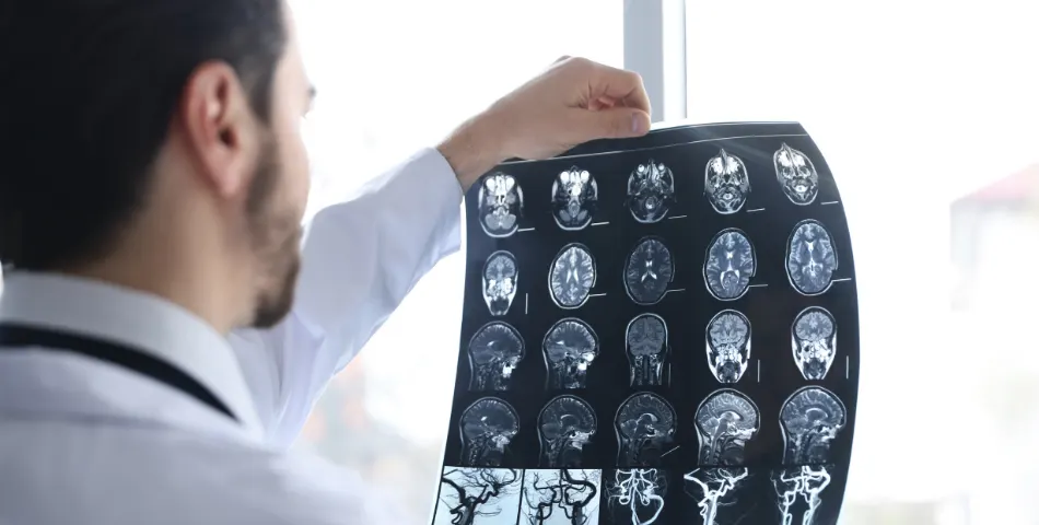 Brain Death Motor Vehicle Accident